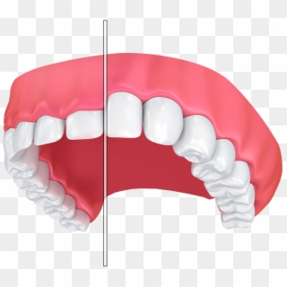Gum Contouring For Small Teeth - Gums, HD Png Download
