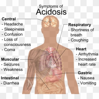 Symptoms Of Acidosis - Importance Of Ph Value In Daily Life, HD Png Download