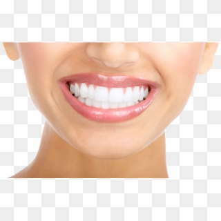 White Teeth Png Clipart - Beautiful Teeth, Transparent Png