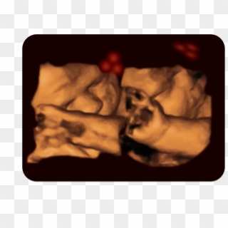 A 4-d Ultrasound Of A Fetus Tracking The Stimulus - Fetus, HD Png Download