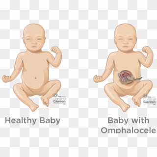 Typically, During Week 6 To 10 Of Pregnancy, A Baby's - Bronchopulmonary Sequestration Bps, HD Png Download