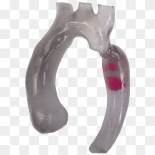 3d Printed Aortic Arch With Thrombus - Diagonal Pliers, HD Png Download