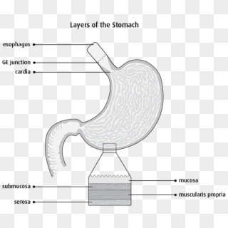 Diagram Of The Layers Of The Stomach - Ca Stomach Staging, HD Png Download
