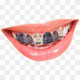 Buck Teeth - White Teeth Png, Transparent Png