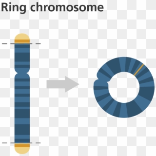 Balanced Vs Unbalanced Structural Abnormalities - Ring Chromosome, HD Png Download