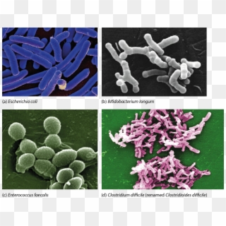 Electron Micrographs Of Bacteria Commonly Associated, HD Png Download