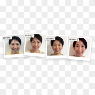 As I Was Approaching My 40's I Noticed My Face Started - Yoga Face Before And After, HD Png Download