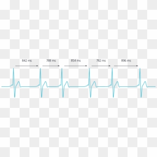 The Medical School's Article Notes How Each Individual's - Real Heart Rate Graph, HD Png Download