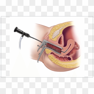 In This Department, All Laparoscopic Surgeries Are - Hysteroscopy, HD Png Download