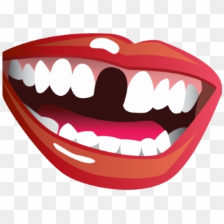 Missing Teeth Cliparts - Missing Tooth Clip Art, HD Png Download