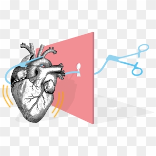 Surgery Drawing Open Heart - Minimally Invasive Cardiac Surgery Logo, HD Png Download