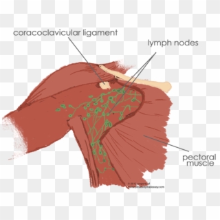 The Removal Of The Breast From A Female Reproductive - Muscle Connected To Breast, HD Png Download