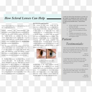 Page1 Page2 - Scleral Contact Lens Brochure, HD Png Download