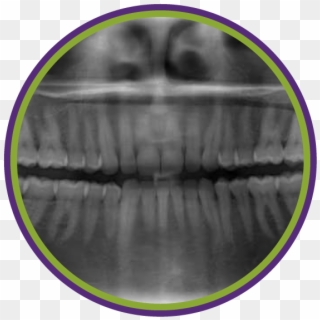 Situation And Request X-rays Only When Necessary Based - All Teeth X Ray, HD Png Download