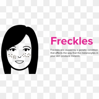 Freckles Png - Cartoon, Transparent Png