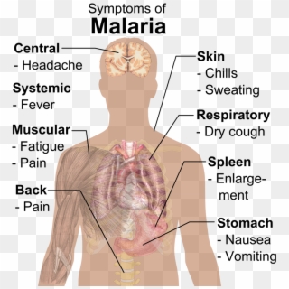 Symptoms Of Malaria - Malaria Symptoms, HD Png Download