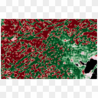 Ai Image Overlay Of Pathology Image - Artificial Intelligence, HD Png Download