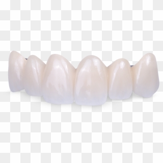 Fused To Metal - Ceramic Teeth Png, Transparent Png