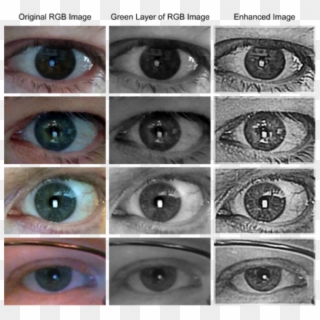 Complaint Filed Against Eye-vein Biometrics Firm 08 - Close-up, HD Png Download