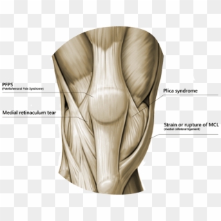 Differential Diagnosis - Patella Muscle, HD Png Download