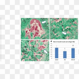 Masson's Trichrome Staining Of Corpora Tissue - Atlas, HD Png Download