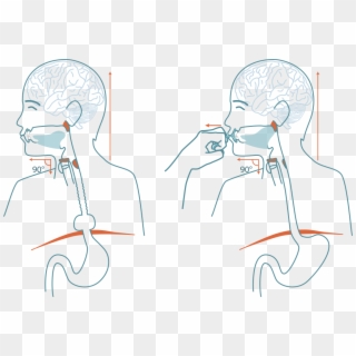 See How The Upper Esophagus Sphincter Does Not Open - Cartoon, HD Png Download