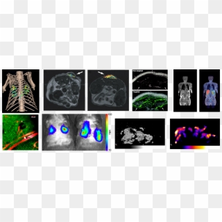 Computed Tomography, HD Png Download