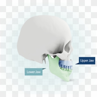 What Is Da's Smile Double Jaw Surgery, HD Png Download