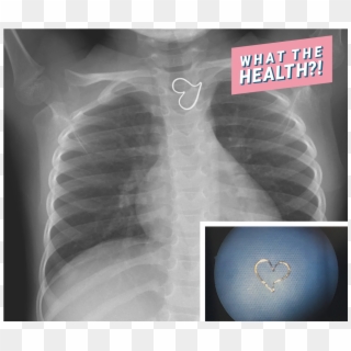 X-ray Heart Medical Doctor Hospital Found Woman Health - X-ray, HD Png Download