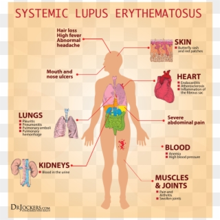 Symptoms Of Low Vitamin D Mayo Clinic - Internal Organs Of Human Body Chart, HD Png Download