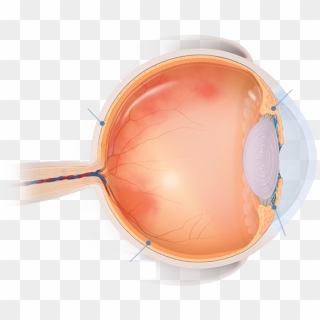 Areas Of The Eye Affected By Uveitis - Circle, HD Png Download