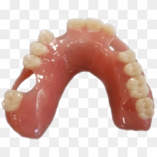 Add Tooth To Existing Acrylic Denture - Acrylic Denture, HD Png Download