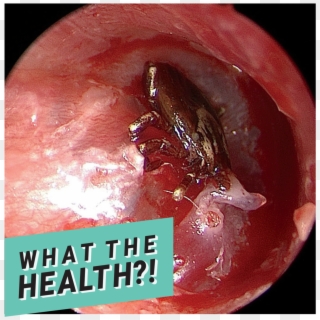 Doctors Removed A Tick From This Boy's Eardrum After - Eardrum, HD Png Download