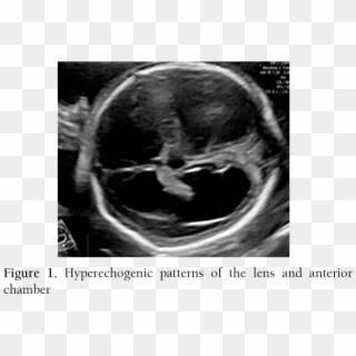 Images - Computed Tomography, HD Png Download