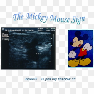 Mickey Mouse Sign - Mickey Mouse, HD Png Download