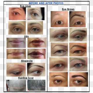 Before And After - Collage, HD Png Download