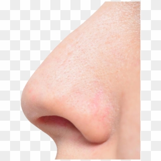 Human Nose - Freckle, HD Png Download