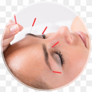 Louisville Acupuncture Clinic Conditions Treated With - Eyelash Extensions, HD Png Download