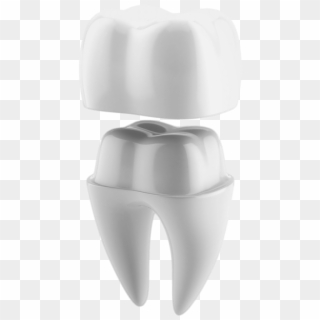 Illustrated Diagram Of Tooth Getting A Crown Cap - Crown Dental Png, Transparent Png
