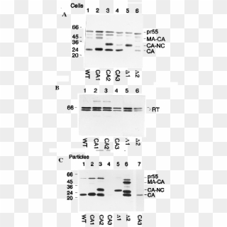 Western Blot Analysis Of Gag And Pol Gene Products - Monochrome, HD Png Download