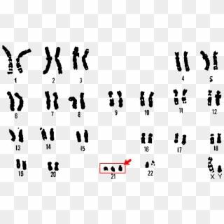 Freeuse Download Aneuploidy Chromosomal Rearrangements - Down Syndrome Genome, HD Png Download