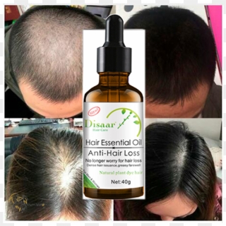 Repairs Follicles And Boosts Hair Growth - Hair Growth Natural Hair Loss Treatment, HD Png Download