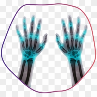 Fingers - X-ray, HD Png Download