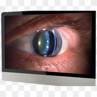 How To Get The Most Out Of Your Slit Lamp Camera - Lampe À Fente, HD Png Download