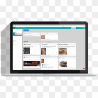 Solution D'images Dermatologie Sfd - Visualization, HD Png Download