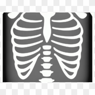 Chest X Ray Cartoon, HD Png Download