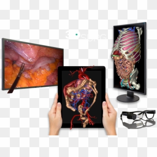 3d Technology Applied To Surgery - Graphic Design, HD Png Download