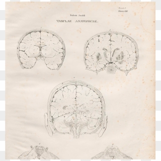 Friedrich Arnold Brain Pic - Drawing, HD Png Download