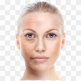 Remove Wrinkles - Skin Whitening Cream In Nepal, HD Png Download