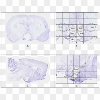 Representative Brain Sections Showing The Extent Of - Drawing, HD Png Download